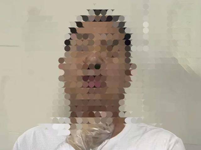 手术损伤神经致九级伤残 南石医院因过错一审被判担责七成(图1)