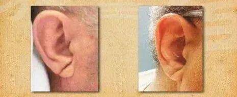 嘴唇发紫是心脏在“求救”？心脏不好的人，脸上会“报警”