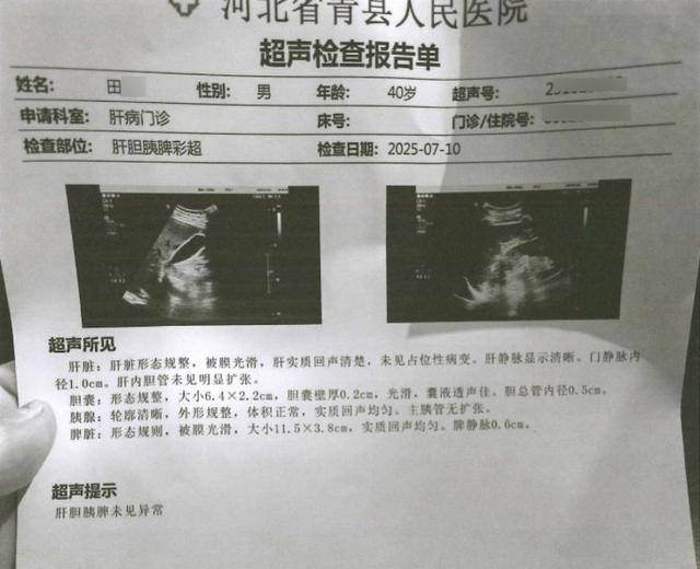 男子意外发现胆囊被切除 从没做过手术怎么就有了手术记录?(图3)