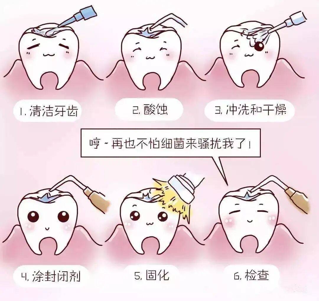 重庆仁品医院科普：儿童涂氟窝沟封闭，科学守护牙齿健康