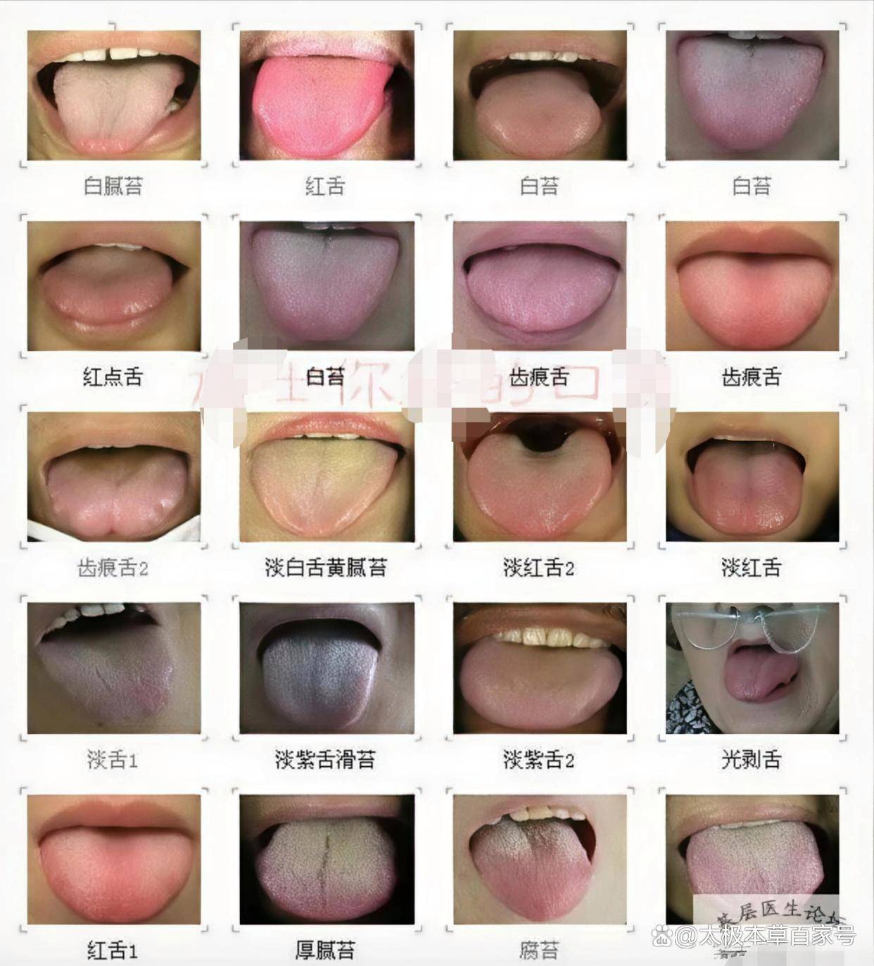 中医舌诊，轻松掌握舌与苔、舌色、津液等健康密码_舌苔_脏腑_人体