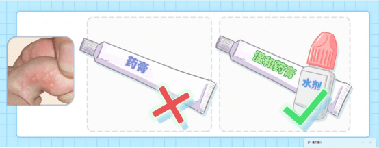 脚总是痒痒、脱皮？想根治看这里