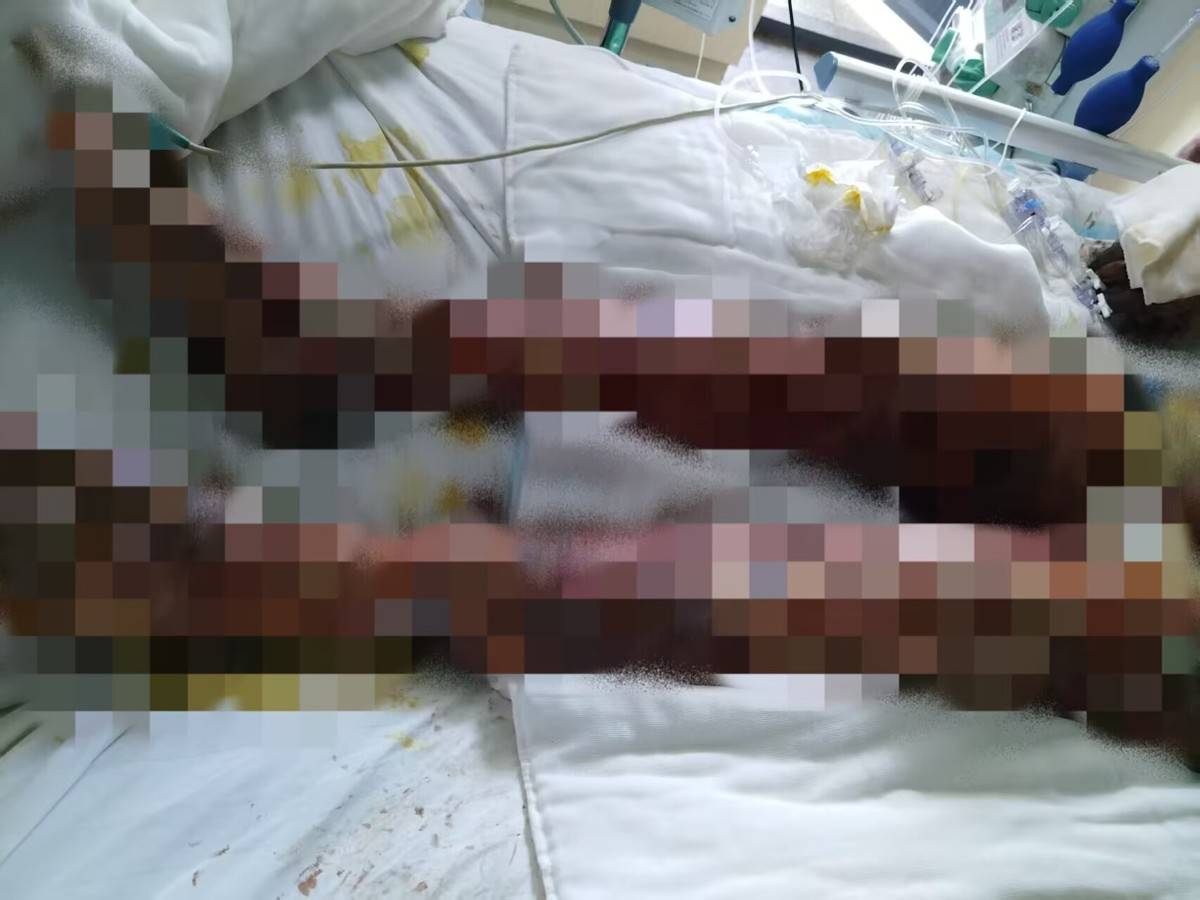 楚雄武定县一起火灾造成3死2伤，家属委托的律师已介入，当地政府：在调查处理
