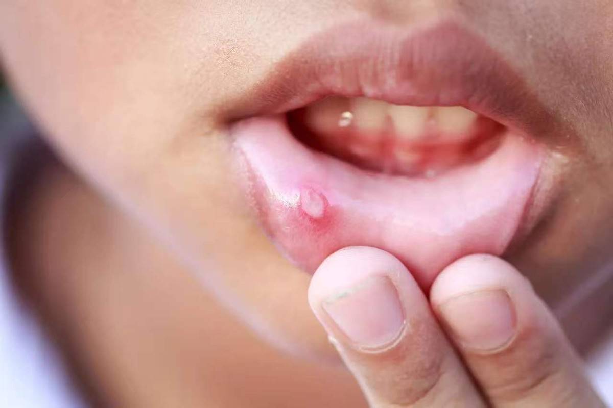原创            体内有癌，嘴先知？提醒：口腔出现这3种迹象，可能是癌症在靠近