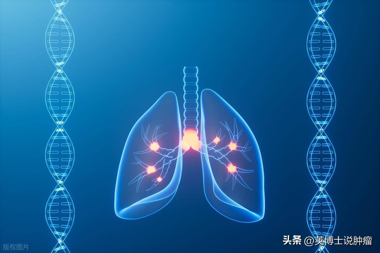 肺癌治疗进入新靶点时代：除了EGFR，这几个方向最值得关注