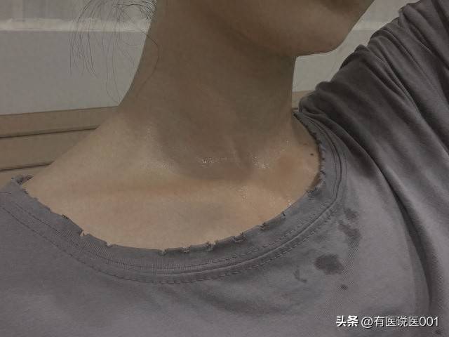 动不动就一身汗？别再当成排毒了，这些信号说明身体在报警